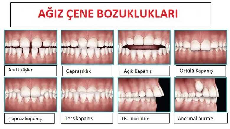 Ağız Çene Yüz Boyun ve Diş Hastalıkları Arıza Dilimleri ve Görevlendirme Çizelgeleri